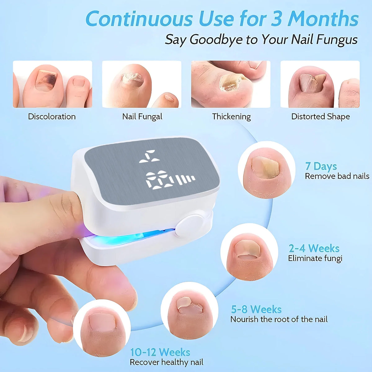 Nail Fungus Treatment | Rechargeable Anti-Fungal Tool for Toenail & Fingernail